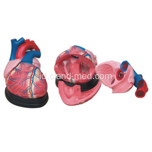 Model Jumbo Heart Medis